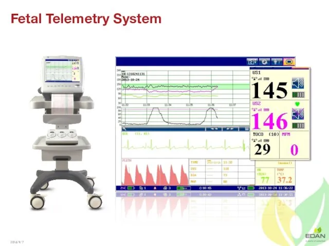 Fetal Telemetry System