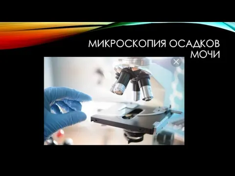 МИКРОСКОПИЯ ОСАДКОВ МОЧИ