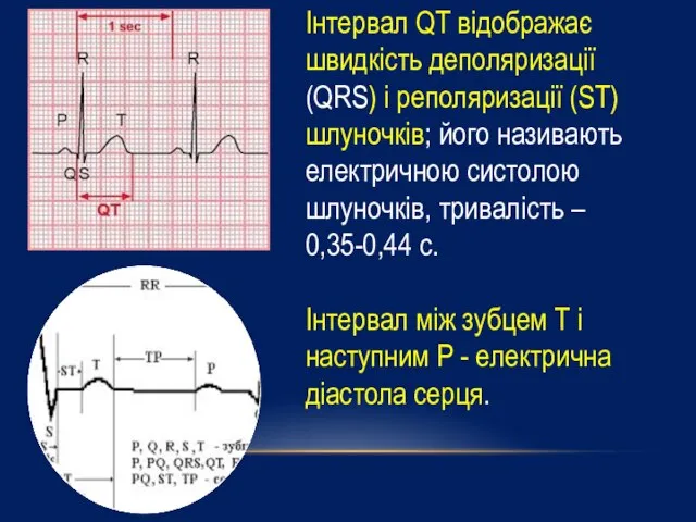 Інтервал QT відображає швидкість деполяризації (QRS) і реполяризації (ST) шлуночків; його