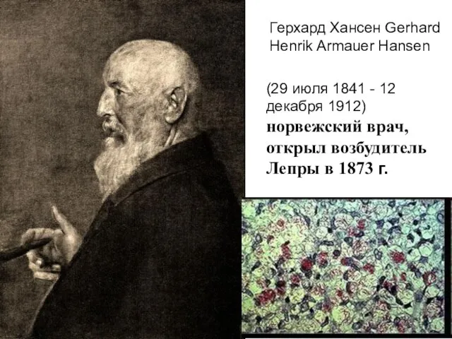 (29 июля 1841 - 12 декабря 1912) норвежский врач, открыл возбудитель