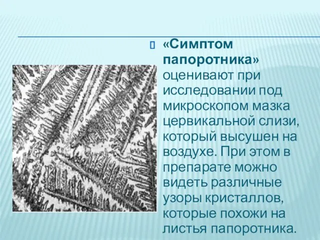 «Симптом папоротника» оценивают при исследовании под микроскопом мазка цервикальной слизи, который