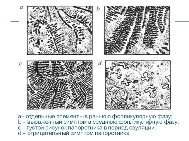 а– отдельные элементы в раннюю фолликулярную фазу; b – выраженный симптом