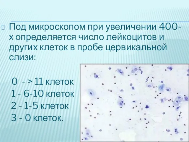 Под микроскопом при увеличении 400- х определяется число лейкоцитов и других