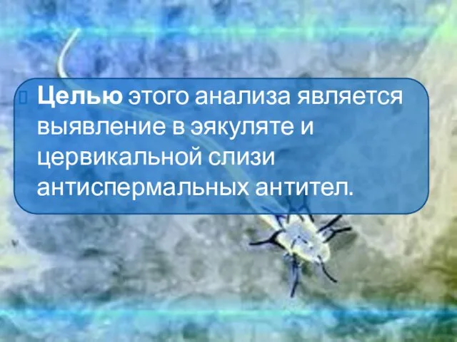 Целью этого анализа является выявление в эякуляте и цервикальной слизи антиспермальных антител.