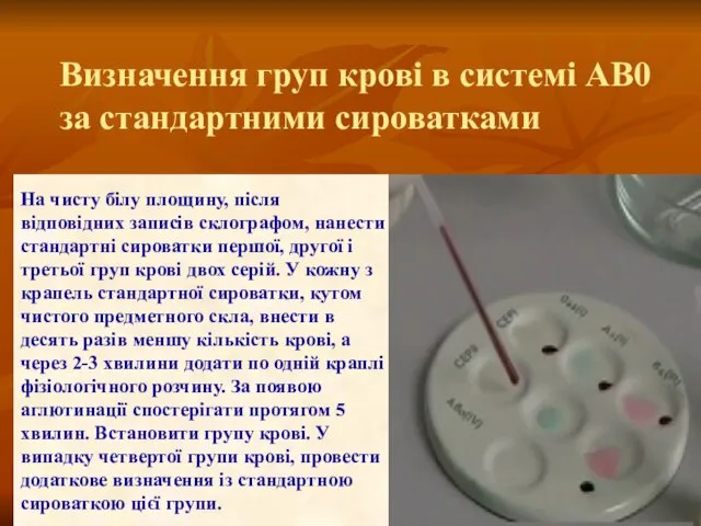 На чисту білу площину, після відповідних записів склографом, нанести стандартні сироватки