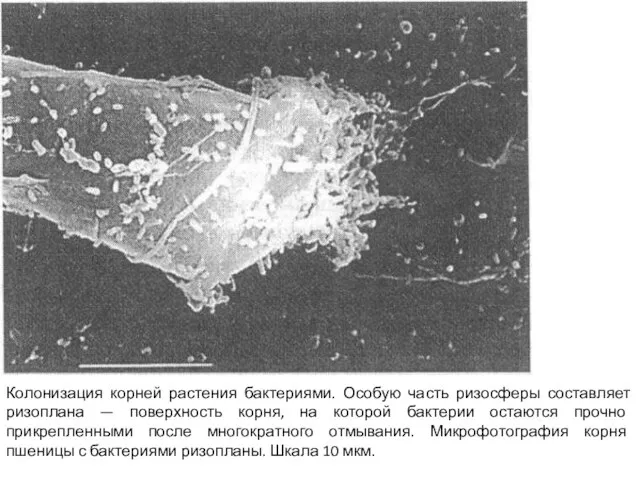 Колонизация корней растения бактериями. Особую часть ризосферы составляет ризоплана — поверхность