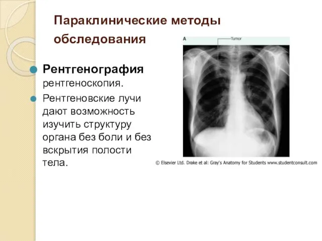 Параклинические методы обследования Рентгенография рентгеноскопия. Рентгеновские лучи дают возможность изучить структуру