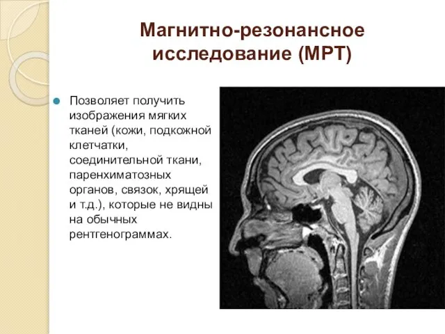 Магнитно-резонансное исследование (МРТ) Позволяет получить изображения мягких тканей (кожи, подкожной клетчатки,