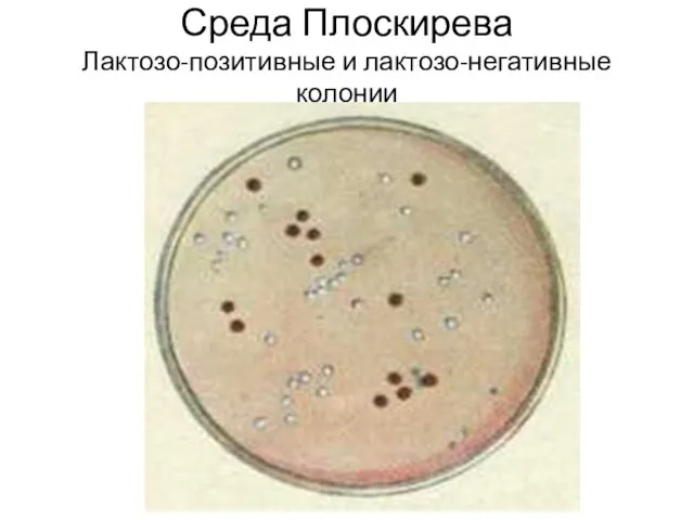 Среда Плоскирева Лактозо-позитивные и лактозо-негативные колонии