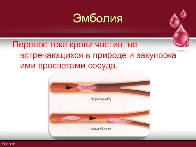 Эмболия Перенос тока крови частиц, не встречающихся в природе и закупорка ими просветами сосуда.