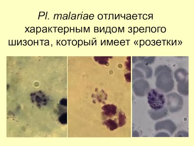 Pl. malariae отличается характерным видом зрелого шизонта, который имеет «розетки»