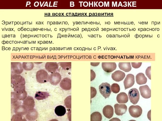 Эритроциты как правило, увеличены, но меньше, чем при vivax, обесцвечены, c