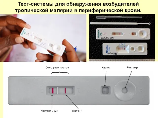 Тест-системы для обнаружения возбудителей тропической малярии в периферической крови. Окно результатов