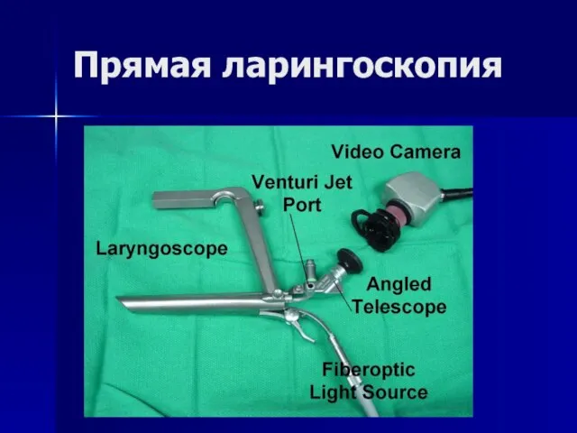 Прямая ларингоскопия