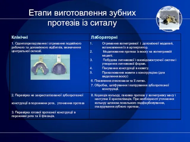 Етапи виготовлення зубних протезів із ситалу