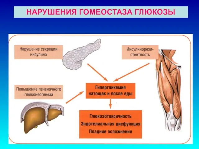 НАРУШЕНИЯ ГОМЕОСТАЗА ГЛЮКОЗЫ