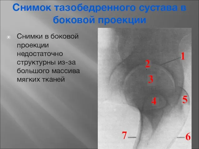 Снимки в боковой проекции недостаточно структурны из-за большого массива мягких тканей