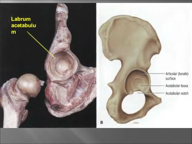 Labrum acetabulum