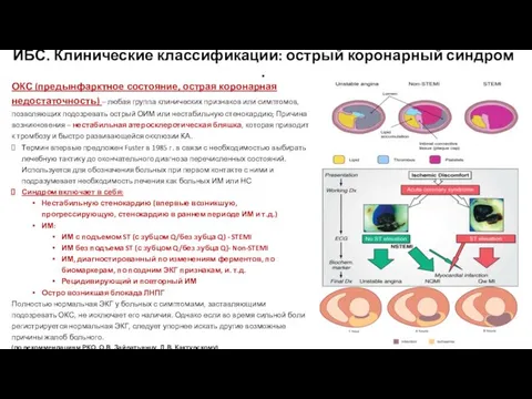 ИБС. Клинические классификации: острый коронарный синдром . ОКС (предынфарктное состояние, острая