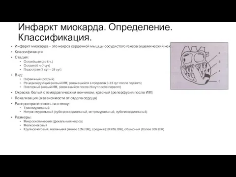 Инфаркт миокарда. Определение. Классификация. Инфаркт миокарда – это некроз сердечной мышцы