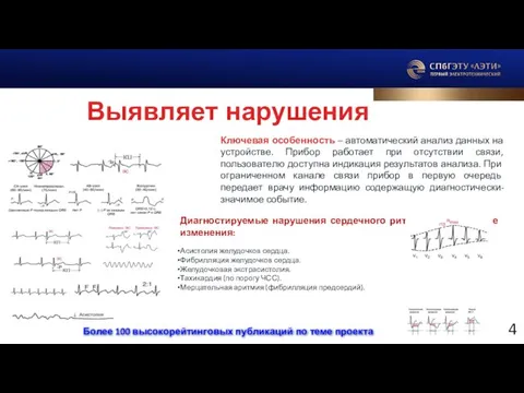 Выявляет нарушения Ключевая особенность – автоматический анализ данных на устройстве. Прибор