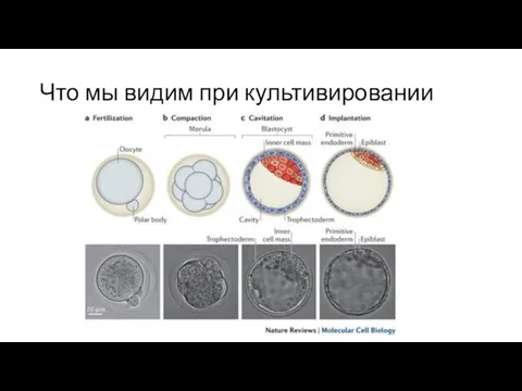 Что мы видим при культивировании