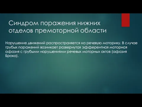 Синдром поражения нижних отделов премоторной области Нарушение движений распространяется на речевую