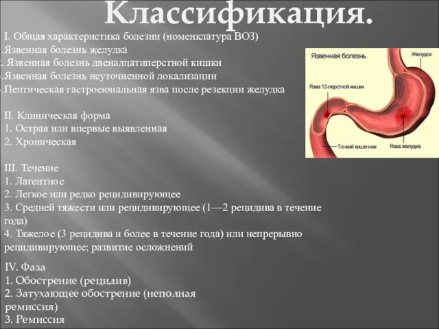 Классификация. I. Общая характеристика болезни (номенклатура ВОЗ) Язвенная болезнь желудка Язвенная