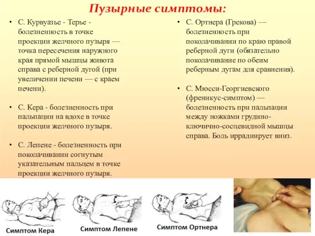 Пузырные симптомы: С. Курвуазье - Терье - болезненность в точке проекции