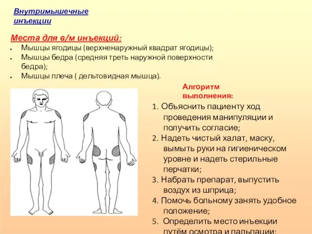 Внутримышечные инъекции Места для в/м инъекций: Мышцы ягодицы (верхненаружный квадрат ягодицы);