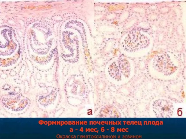Формирование почечных телец плода а - 4 мес, б - 8 мес Окраска гематоксилином и эозином
