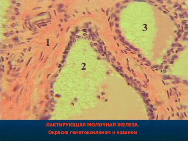 ЛАКТИРУЮЩАЯ МОЛОЧНАЯ ЖЕЛЕЗА. Окраска гематоксилином и эозином