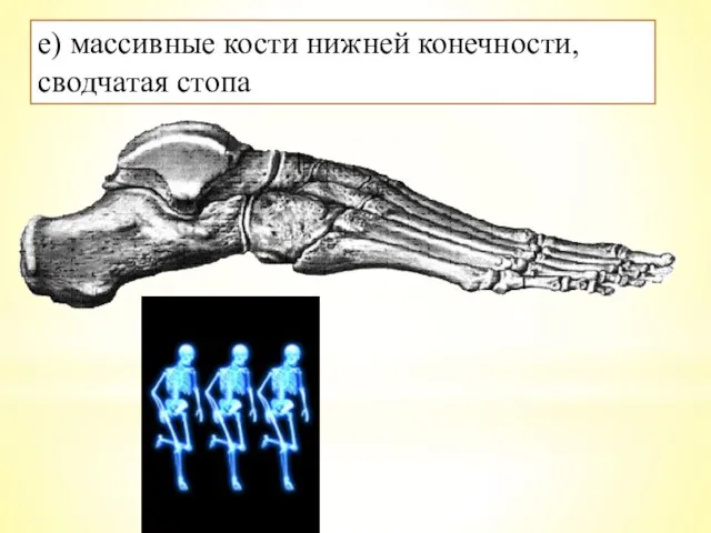 е) массивные кости нижней конечности, сводчатая стопа