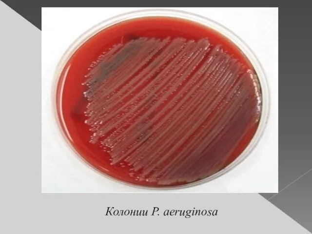 Колонии P. aeruginosa