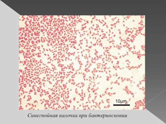 Синегнойная палочка при бактериоскопии