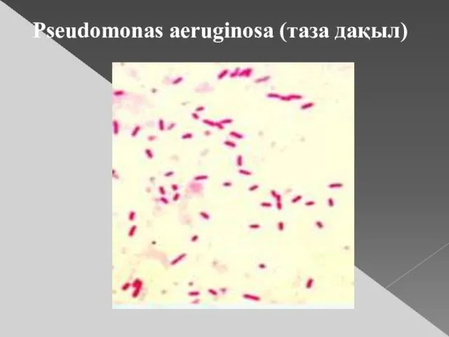 Pseudomonas aeruginosa (таза дақыл)