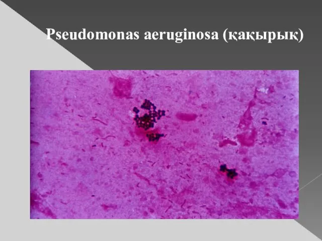 Pseudomonas aeruginosa (қақырық)
