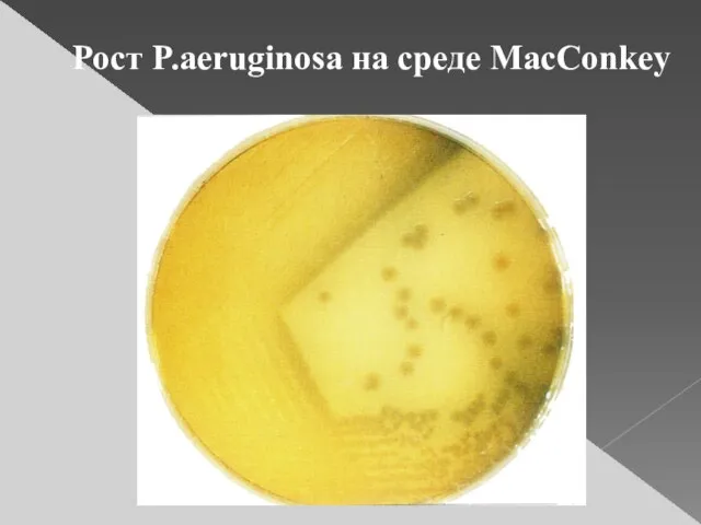 Рост P.aeruginosa на среде MacConkey