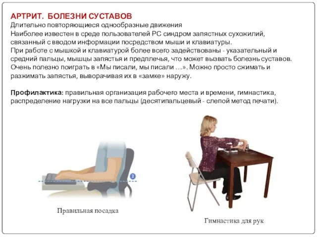 АРТРИТ. БОЛЕЗНИ СУСТАВОВ Длительно повторяющиеся однообразные движения Наиболее известен в среде