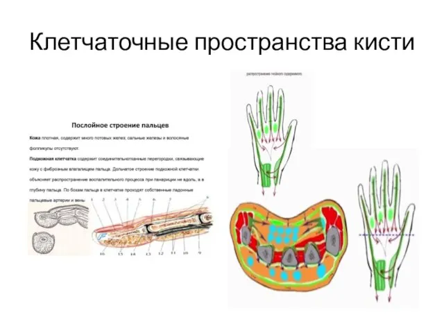 Клетчаточные пространства кисти