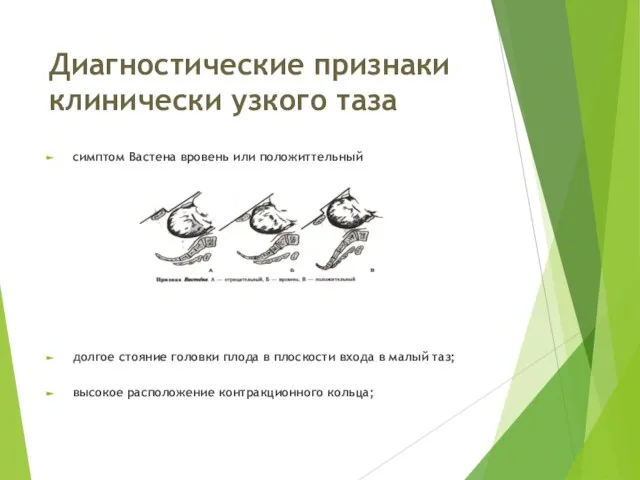 Диагностические признаки клинически узкого таза симптом Вастена вровень или положиттельный долгое