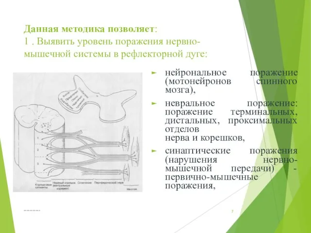 Данная методика позволяет: 1 . Выявить уровень поражения нервно-мышечной системы в