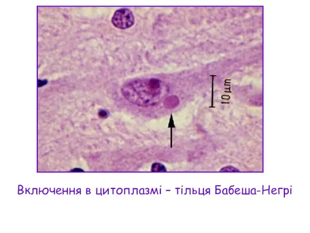 Включення в цитоплазмі – тільця Бабеша-Негрі