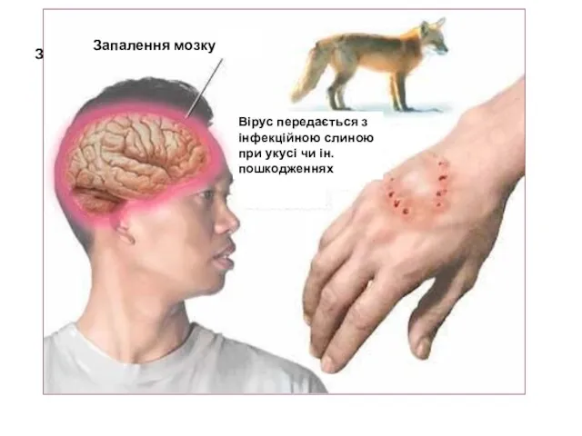 Запалення мозку Запалення мозку Вірус передається з інфекційною слиною при укусі чи ін. пошкодженнях