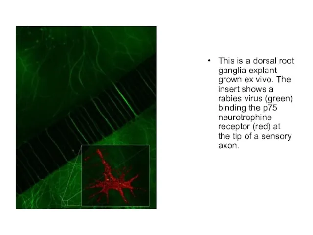 This is a dorsal root ganglia explant grown ex vivo. The