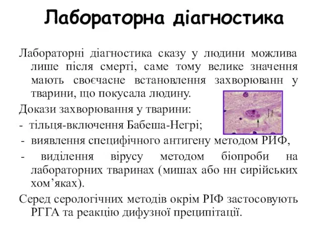 Лабораторна діагностика Лабораторні діагностика сказу у людини можлива лише після смерті,