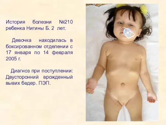 История болезни №210 ребенка Нигины Б. 2 лет. Девочка находилась в