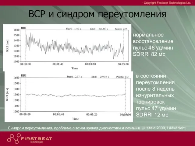 нормальное восстановление пульс 48 уд/мин SDRRI 82 мс в состоянии переутомления