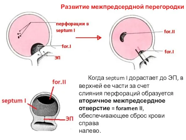 Когда septum I дорастает до ЭП, в верхней ее части за