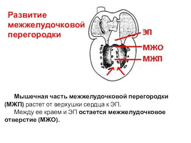 Развитие межжелудочковой перегородки Мышечная часть межжелудочковой перегородки (МЖП) растет от верхушки